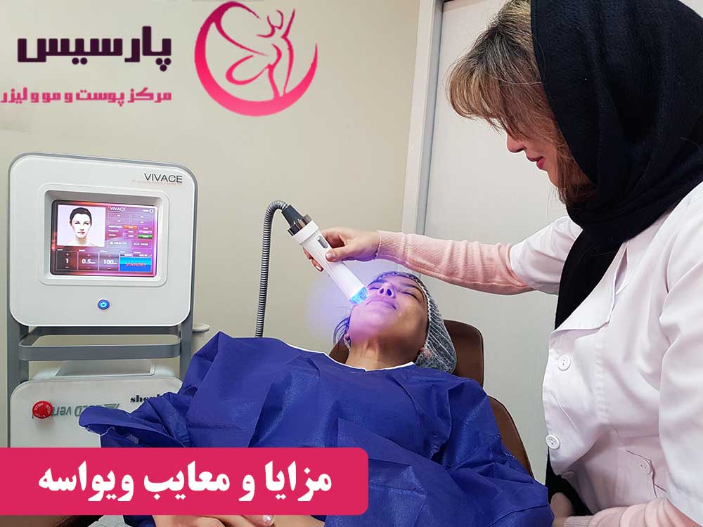 مزایا و معایب ویواسه