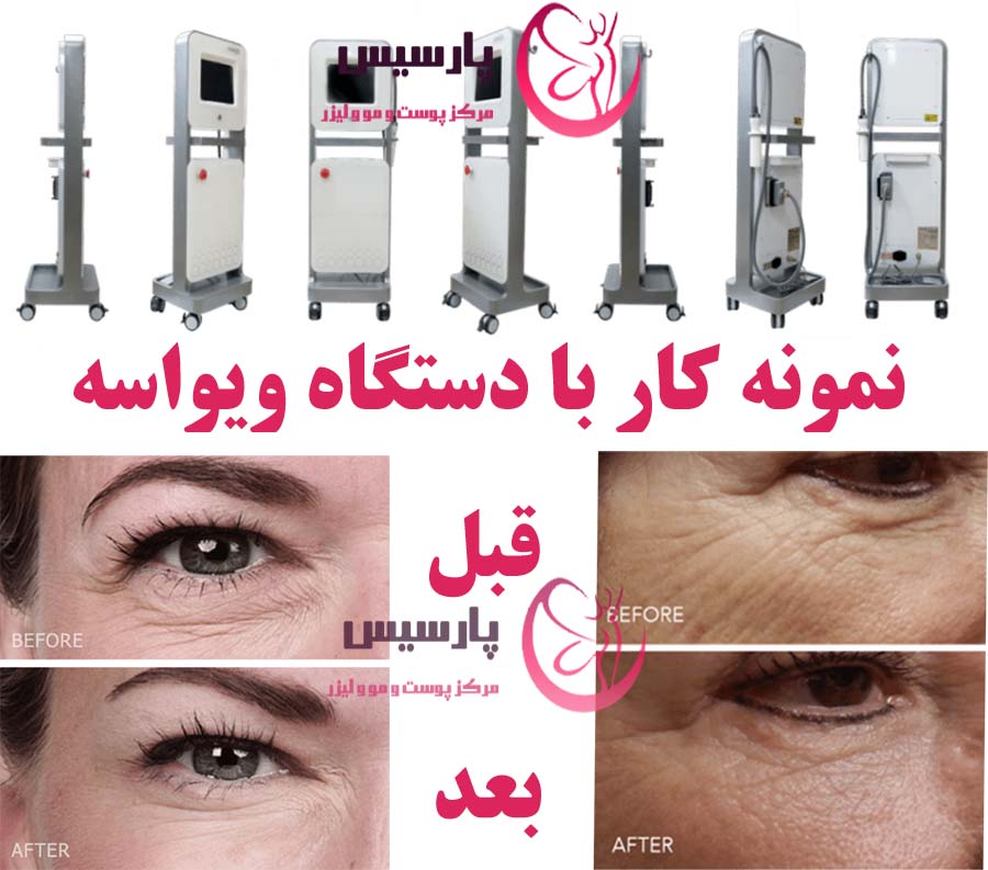 نمونه کار ویواسه
