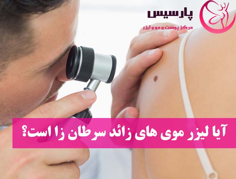 آیا لیزر موهای زائد سرطان زا است؟