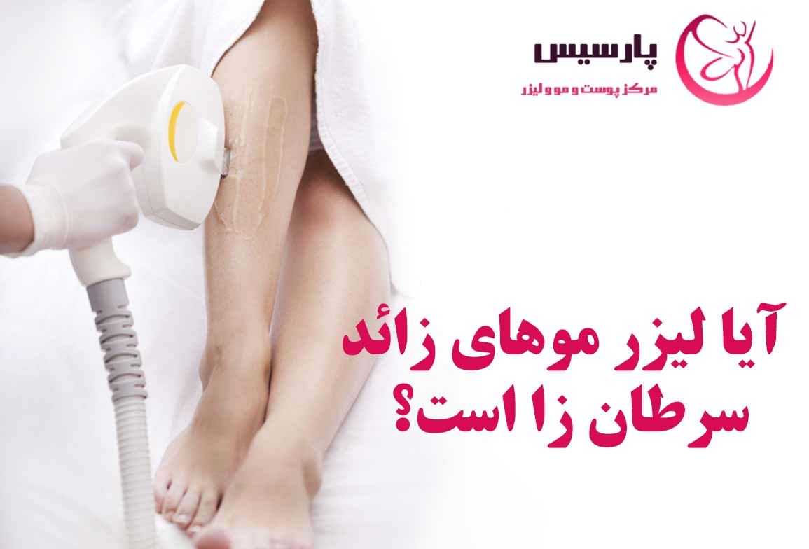 آیا لیزر موهای زائد سرطان زا است؟