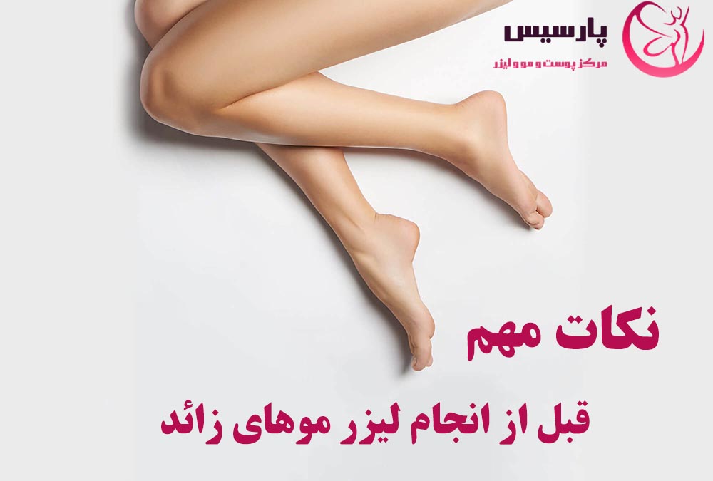 نکات مهم قبل از انجام لیزر موهای زائد