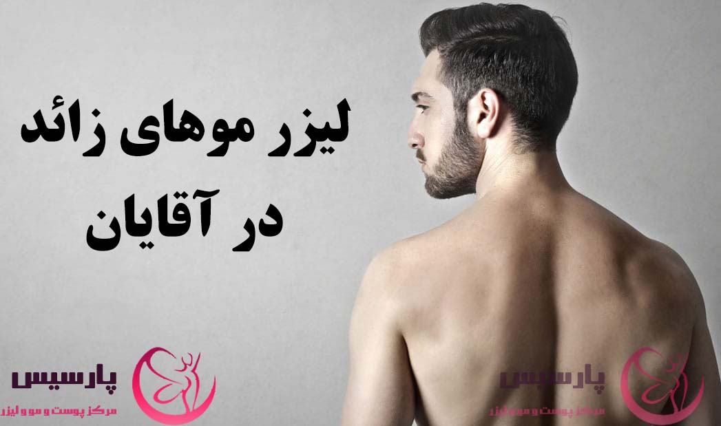 لیزر موهای زائد در مردان