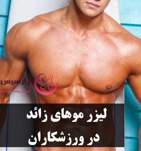 لیزر موهای زائد مردان ورزشکار