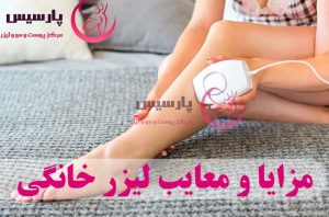 مزایا و معایب دستگاه‌ لیزر خانگی