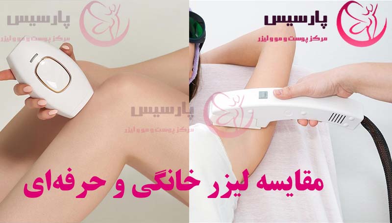 مقایسه لیزر موهای زائد خانگی و حرفه‌ای
