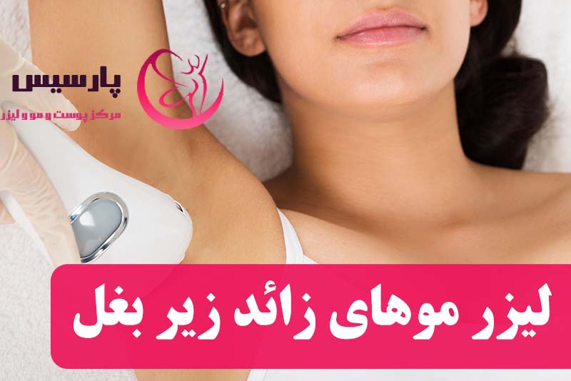 لیزر موهای زائد زیر بغل