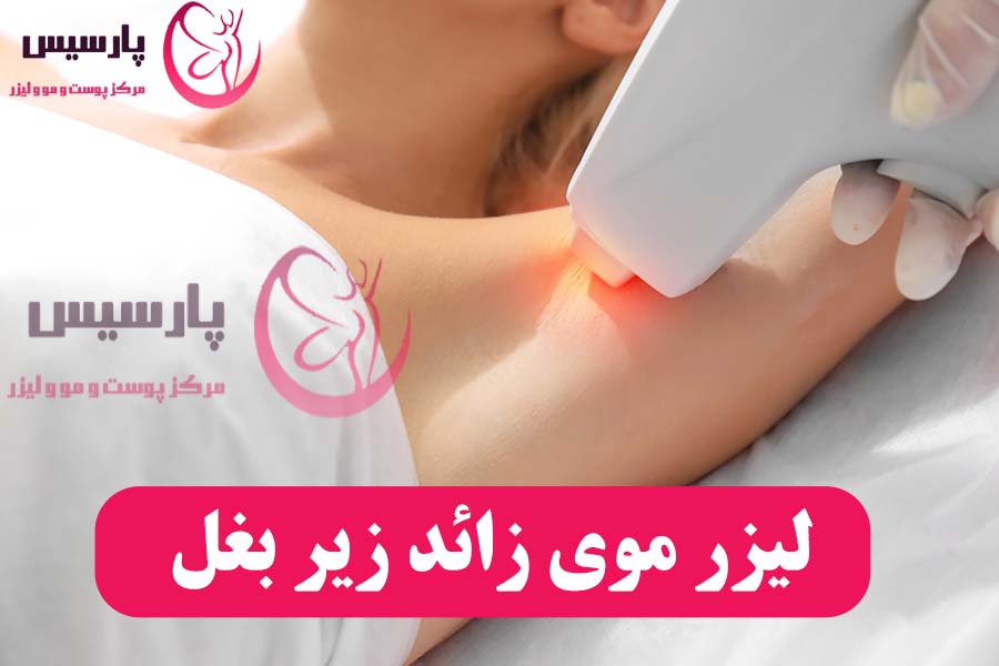 لیزر موی زائد زیر بغل