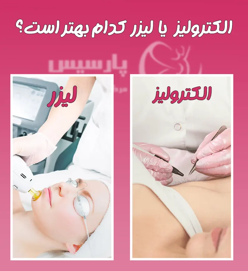 الکترولیز موهای زائد یا لیزر کدام بهتر است؟