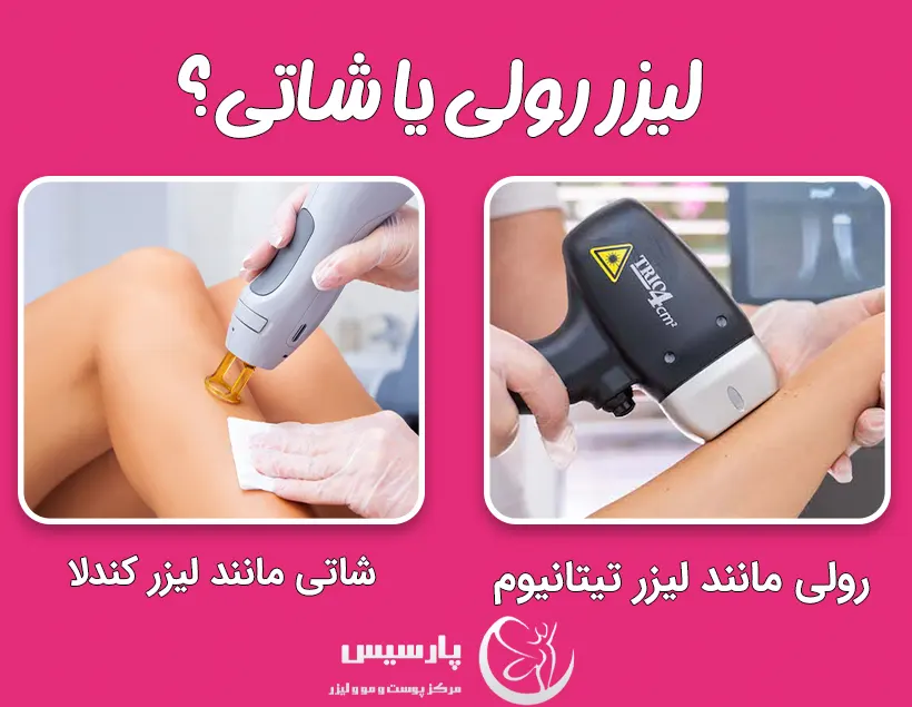 لیزر رولی یا شاتی