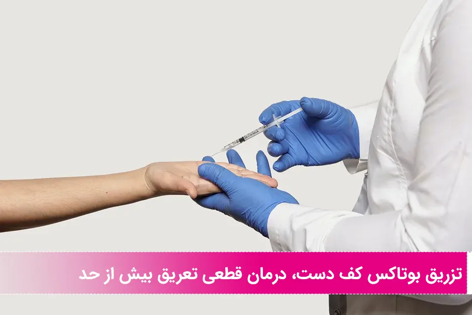 بوتاکس کف دست