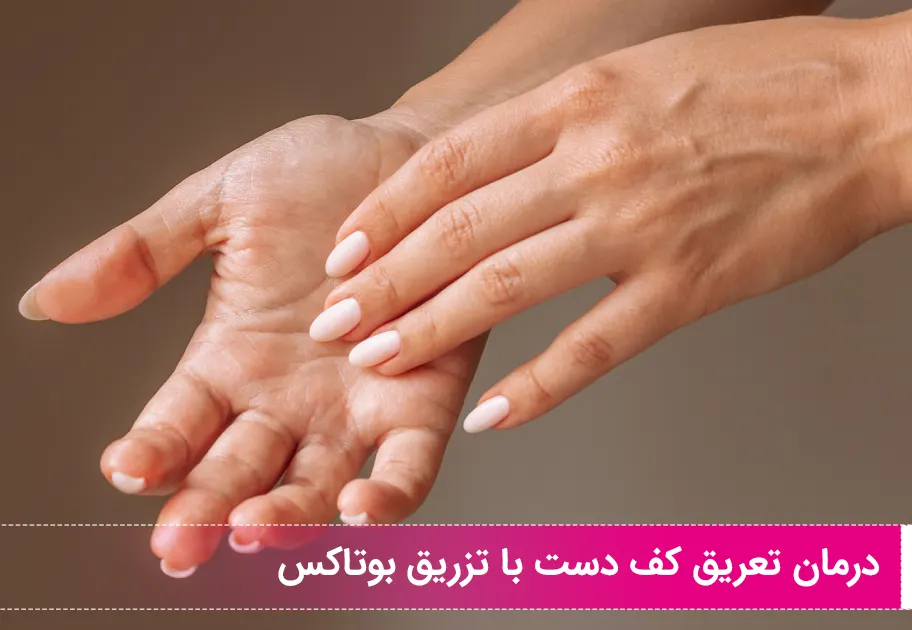 درمان تعریق کف دست با بوتاکس