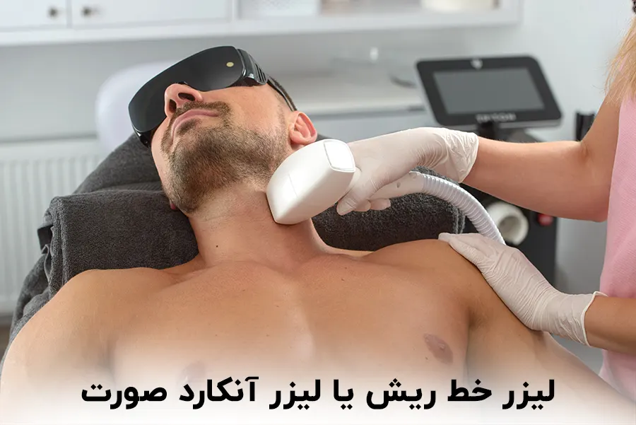 لیزر خط ریش