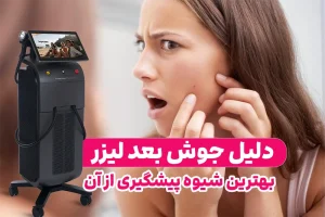 دلیل جوش بعد لیزر