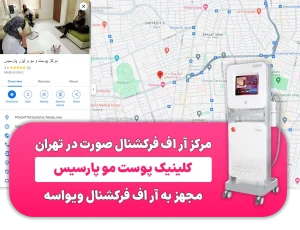 مرکز آر اف فرکشنال صورت در تهران