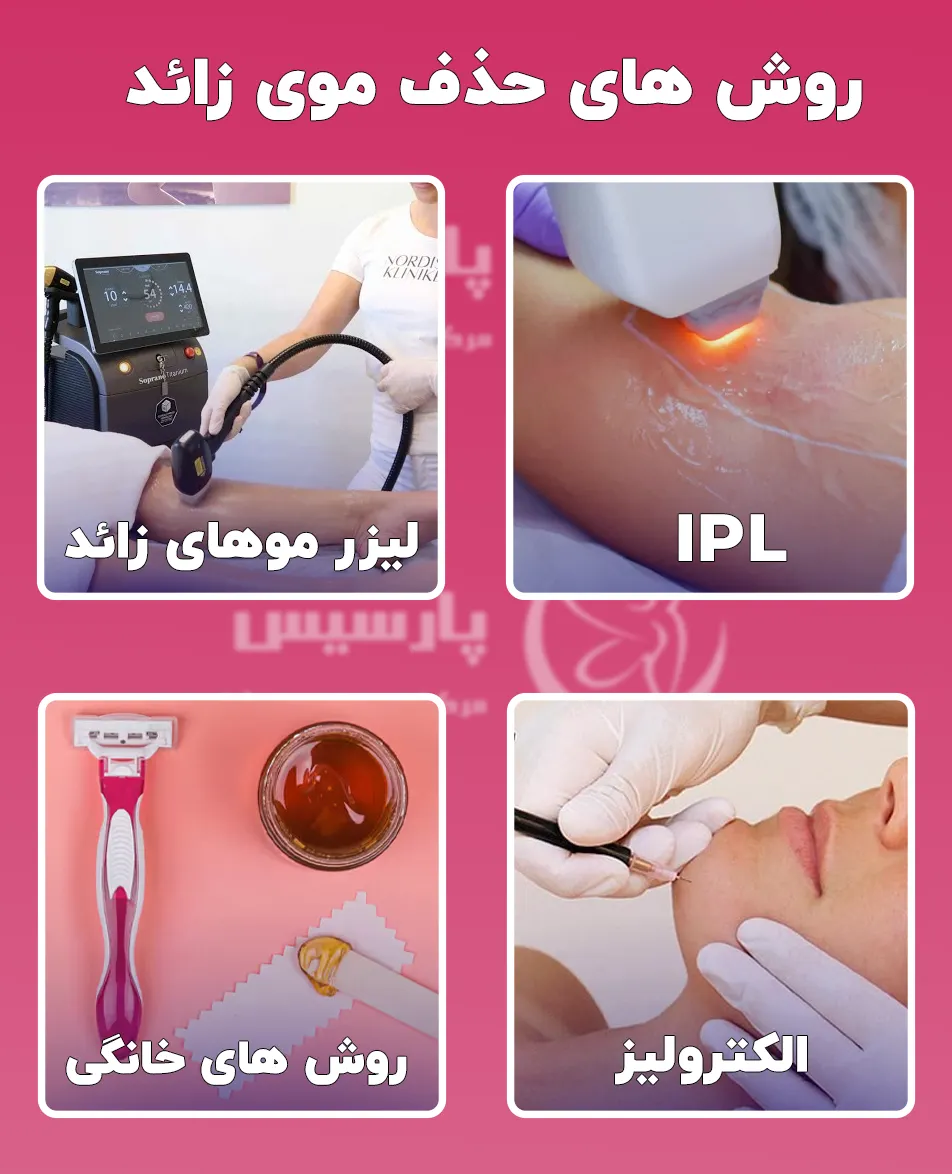روش های حذف مو زائد