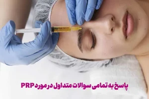 پاسخ به سوالات متداول در مورد PRP