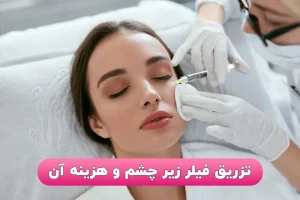تزریق فیلر زیر چشم