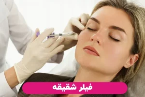 فیلر شقیقه