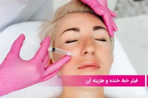 فیلر خط خنده و هزینه آن