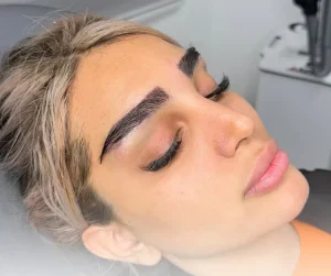 عوارض کاشت ابرو